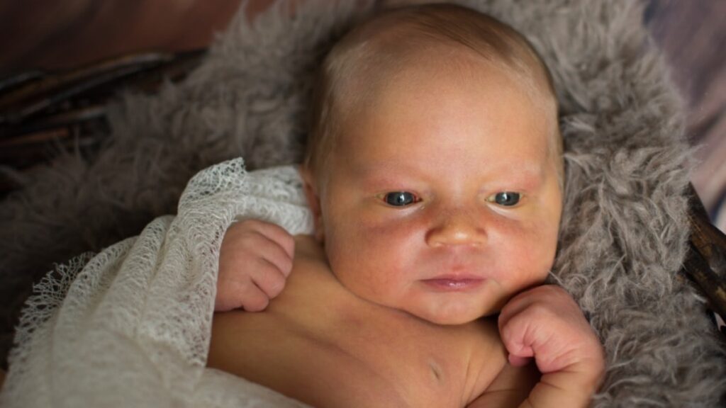 Yenidoğanlarda sarılık nedir?