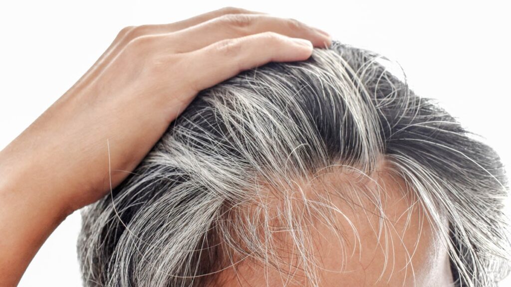 Beyaz saçlar genetik olmayabilir! Saçlarınız hızla beyazlıyorsa vücudunuz size alarm veriyor olabilir