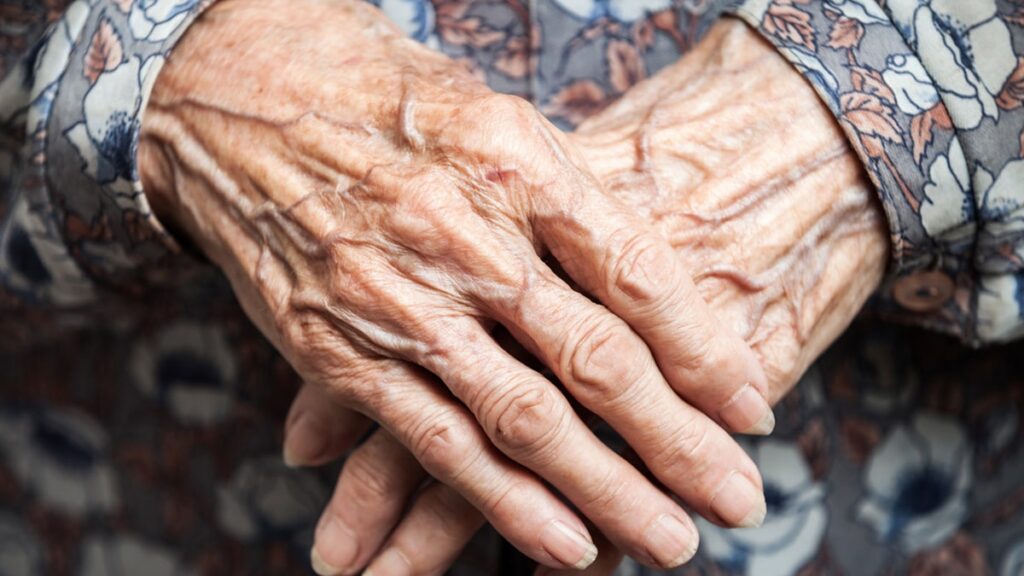 Ellerimizdeki o renkler neyin işareti? Uzmanlardan kritik uyarı