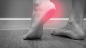 Topuk dikeni nedir? Topuk dikeni nasıl tedavi edilir?