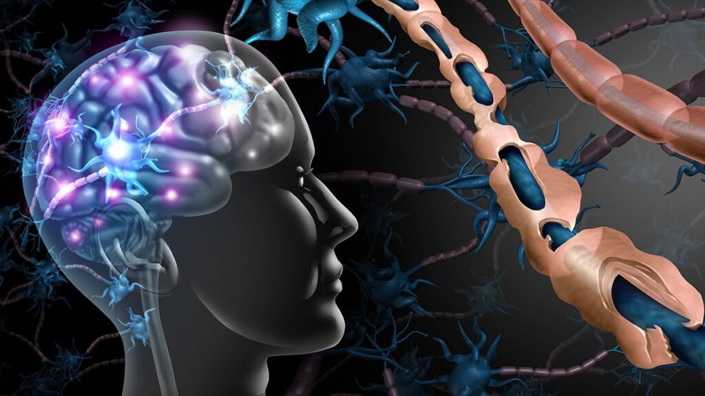 MS tedavisinde yeni umut: Keto diyetindeki mucize…