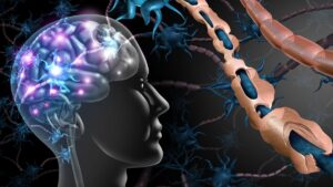 MS tedavisinde yeni umut: Keto diyetindeki mucize…