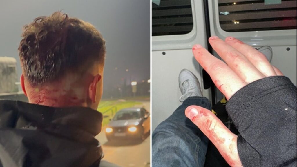 Saraybosna’da Türk taraftarlara saldırı