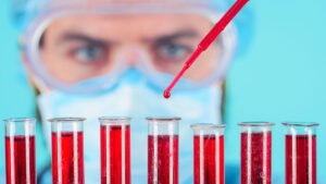 Şaşırtan sonuç! Düşük zeka düzeyine sahip olan kan grubu açıklandı