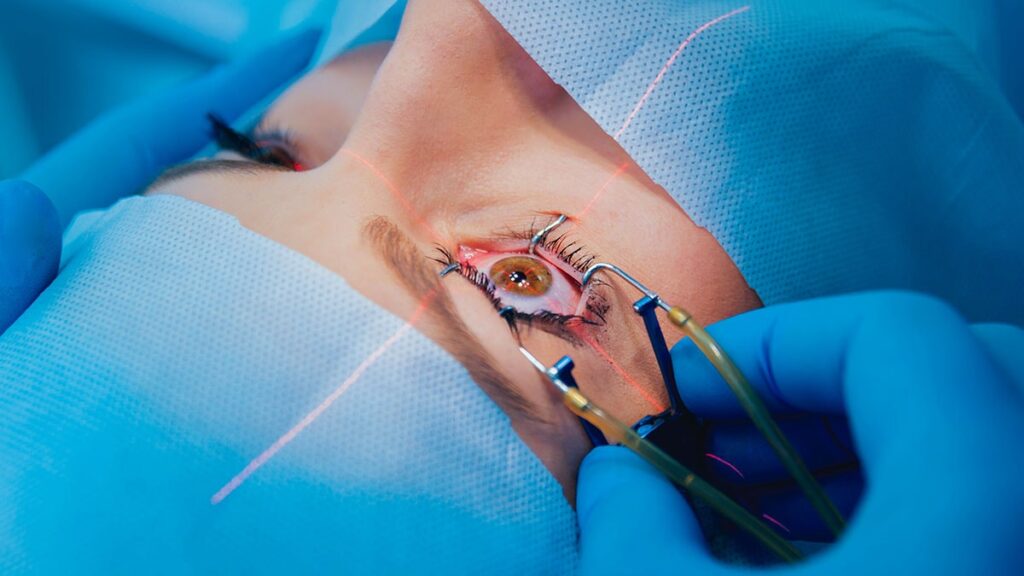 Tıp dünyası şaşkın: Kadının göz kapağından 4 solucan çıktı