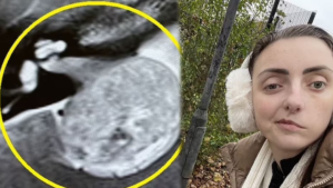 Göz seğirmesini ciddiye alın!