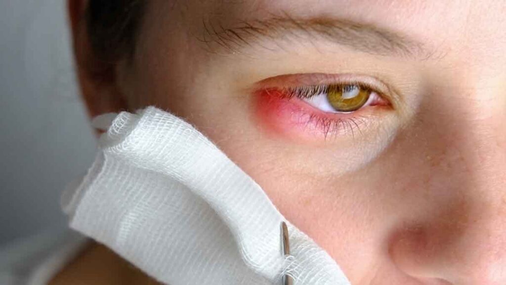 Gözleri kanatan ölümcül virüs salgını: 8 kişi öldü, işte belirtiler