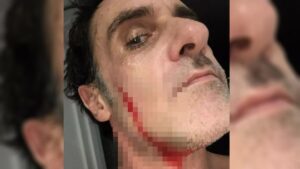 Tıraş olurken kendini kesince 211 bin lira kazandı