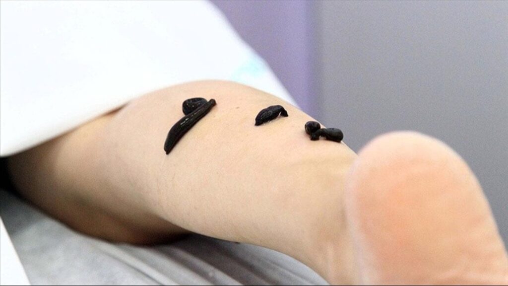 Bakanlıktan sertifikalı sülükçülük