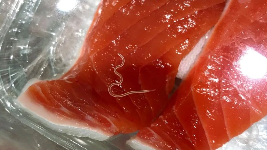 Milyonların yediği yemekten yedi: Beyninde kurt çıktı