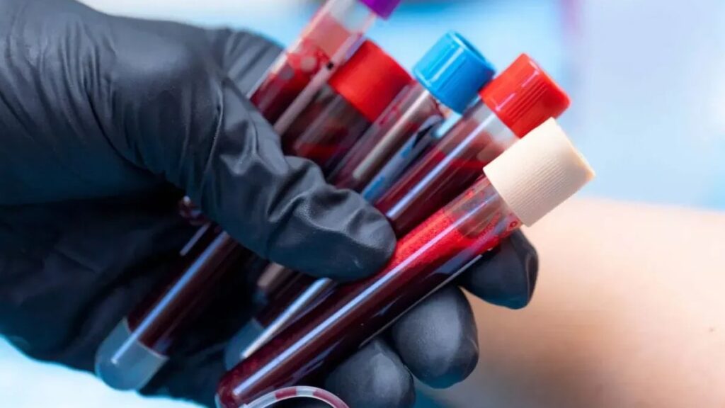 Balık hafızalı kan grupları ortaya çıktı: Ne yediğini bile unutuyorlar