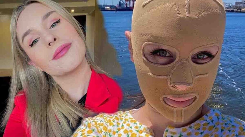 Hayatı saniyeler içinde değişti: Artık sürekli maske takmak zorunda