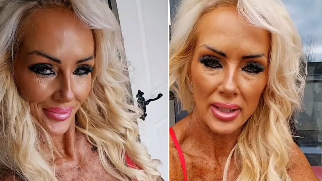 Solaryum bağımlısı kadın son halini paylaştı: Mahvoldum, çok pişmanım