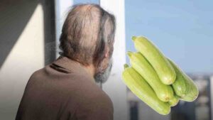 Kabak yedikten sonra hayatı kabusa döndü: Kusma, deri soyulması, saç dökülmesi… Sebebi günler sonra anlaşıldı