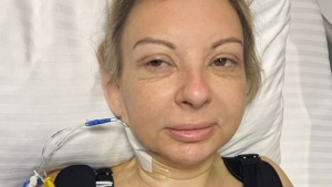 Estetik olan kadın ‘keşke şişman kalsaydım’ diyerek isyan etti