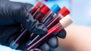 Tıp tarihinde büyük keşif: Bir ilk oldu