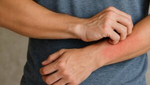 Durduk yere vücudu kaşınanlar yandı: Tehlike büyük