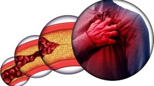 Kolesterol: Düşman mı, denge mi?