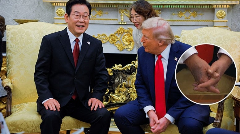 Trump’ın elindeki ‘koyu leke’ dikkat çekti!