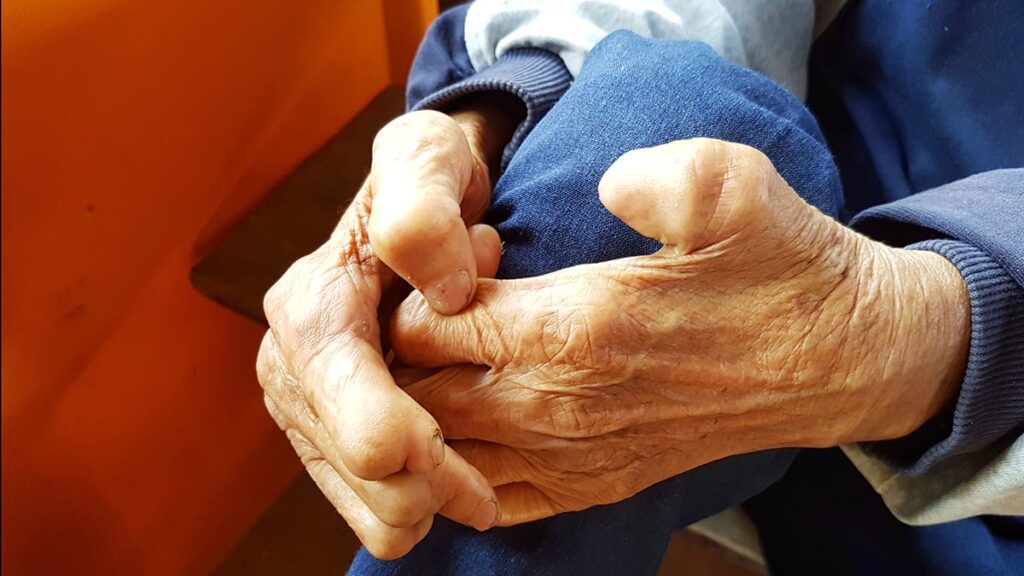 Sadece kemikleriniz değil… Kaslarınız da erimesin