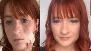 Doğumdan sonra bir fincan çay içti, hayatı adeta kâbusa döndü