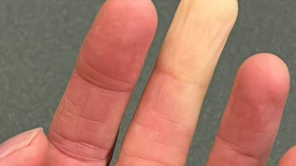 Elleriniz ve ayaklarınız renk değiştiriyorsa bunun tek nedeni üşeme değil