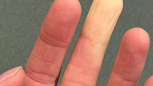 Elleriniz ve ayaklarınız renk değiştiriyorsa bunun tek nedeni üşeme değil