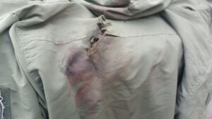 Birinci Dünya Savaşı hastalığı yeniden hortladı: Yüzyıl sonra ilk kez görüldü