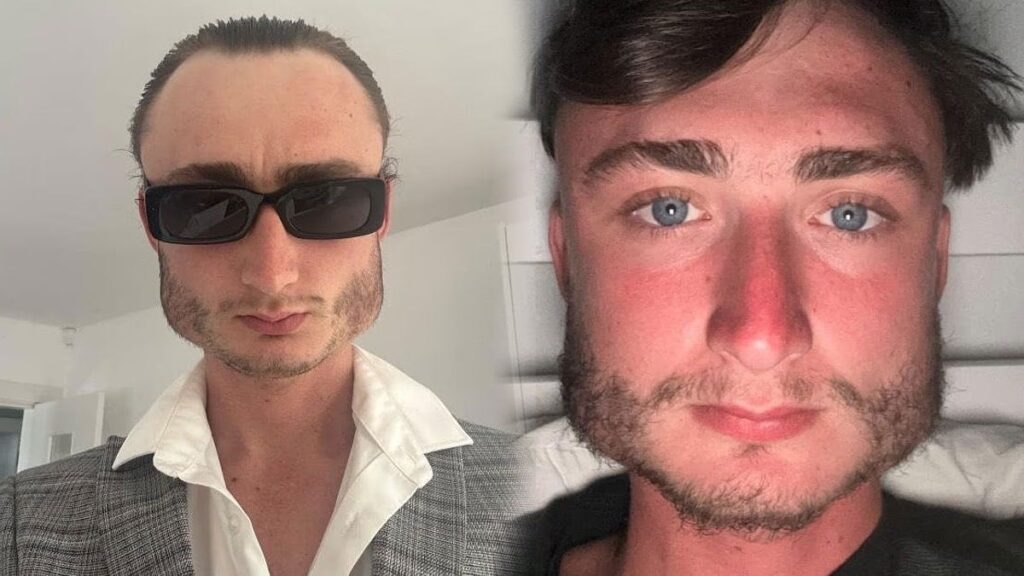 Yıllardır yaptığı spor yüzünden yüzü kare oldu