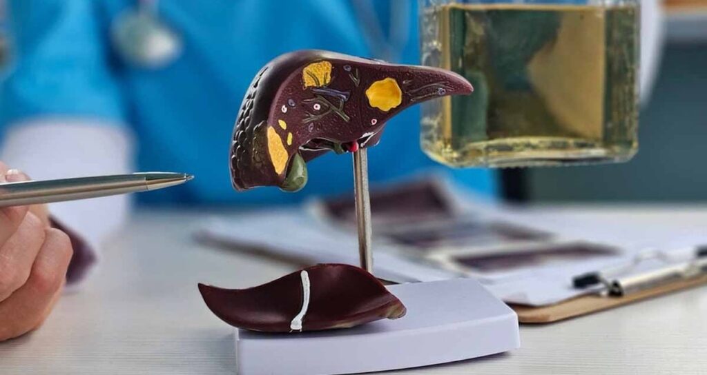 Karaciğer yağlanmasını birkaç günde tersine çeviren menü