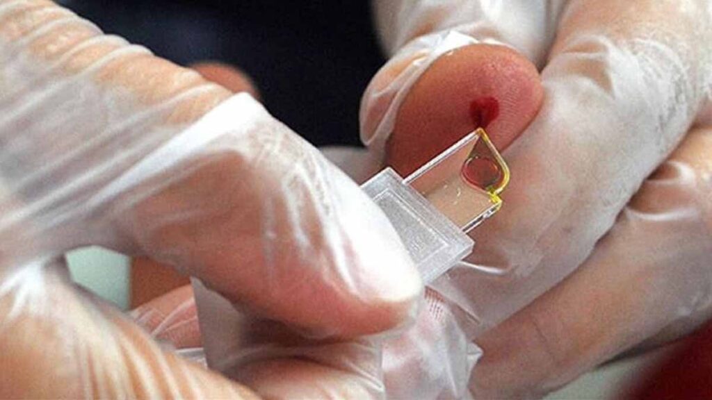 Ne A, ne B, ne de O: Yarım milyon kişiden sadece üçünün sahip olduğu çok nadir bir ‘melez’ kan grubu bulundu